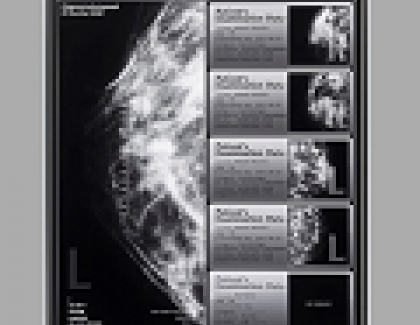 JDI Develops a 21.3-inch Monochrome LTPS TFT Display for Medical Use