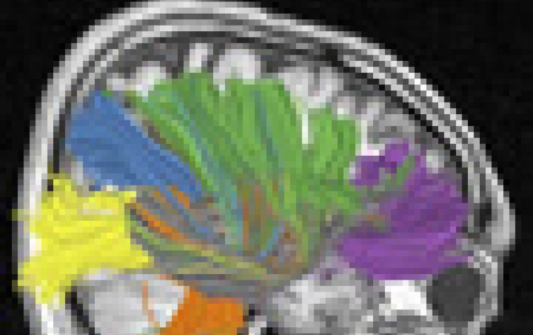 IBM to Bring Brain Insights to Computers